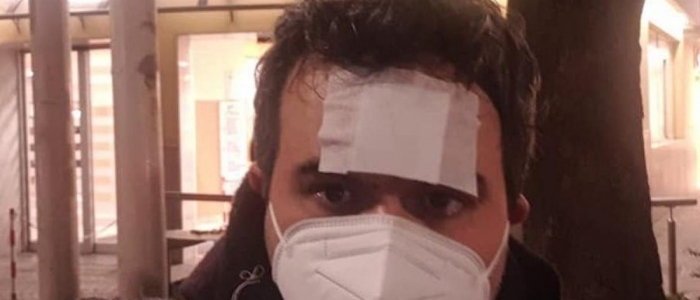 Napoli, supplente rimprovera la classe. Pestato a sangue dai parenti degli alunni