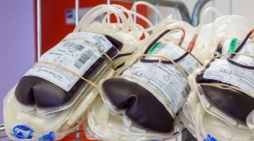 Napoli, morì per una trasfusione di sangue infetto: il Ministero della Salute condannato a un risarcimento da oltre un milione di euro