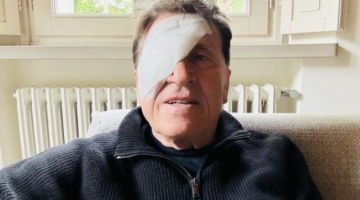 Gianni Morandi con una benda su un occhio scatena il web: "Ho fatto a pugni"
