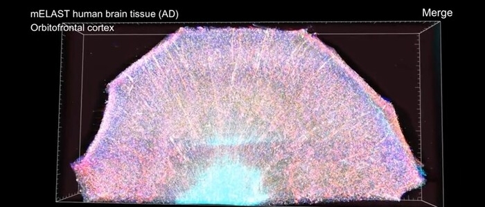 "Zoom" sul cervello: mai visto così in dettaglio