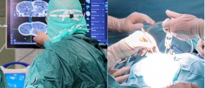 Tumori, Bambino Gesù: rimosso cancro al rene di 1,5 kg a bimba di 8 anni
