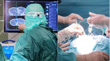 Tumori, Bambino Gesù: rimosso cancro al rene di 1,5 kg a bimba di 8 anni