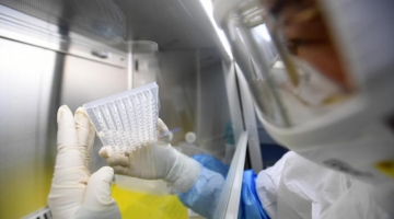 Team cinese scopre un nuovo coronavirus dei pipistrelli: è trasmissibile all'uomo