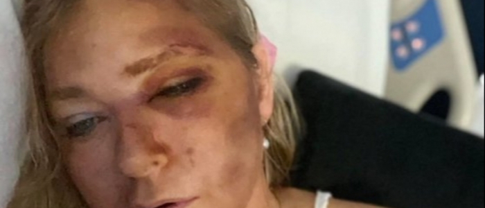 Virginia Giuffre dimessa dall'ospedale: aveva detto di avere solo "quattro giorni di vita"