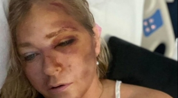 Virginia Giuffre dimessa dall'ospedale: aveva detto di avere solo "quattro giorni di vita"