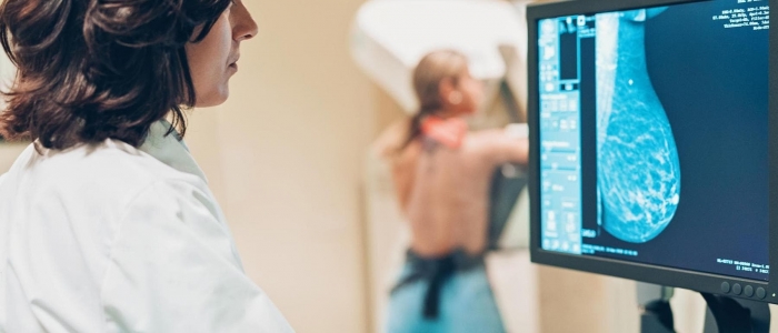 Sos tumori: sempre meno adesioni agli screening, nel 2023 "perse" oltre 50mila diagnosi