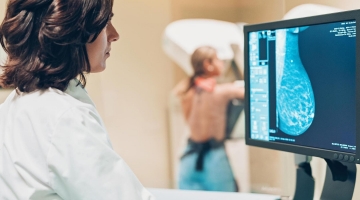 Sos tumori: sempre meno adesioni agli screening, nel 2023 "perse" oltre 50mila diagnosi