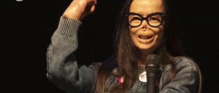 L'ex senatore D'Anna e la frase shock a Valentina Pitzalis bruciata dal marito: "La moglie? A chi piace cruda e a chi cotta" | La replica: "Pessimo gusto"