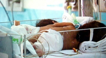 Bimbo trapiantato, il cuore destinato a Domenico ha salvato la vita a un altro piccolo