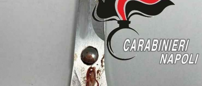 Napoli, prende a forbiciate la moglie dopo una lite: arrestato